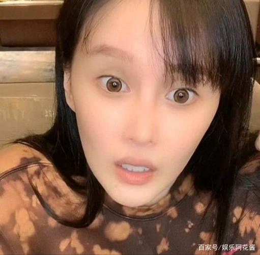 赵本山女儿承认整容,花30万做鼻子,回怼网友:我家就是有条件