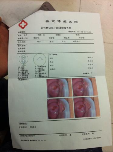 请问宫颈糜烂i度不手术药物冶疗可以吗?如