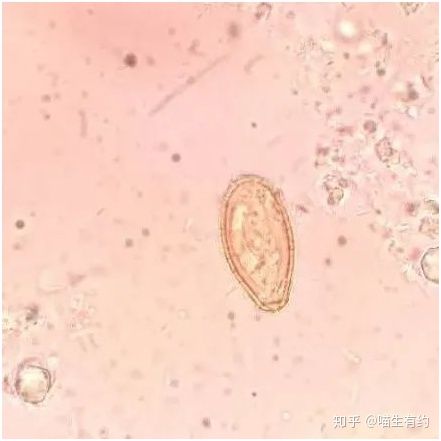 还有,这个球虫,像不像一只大眼睛.