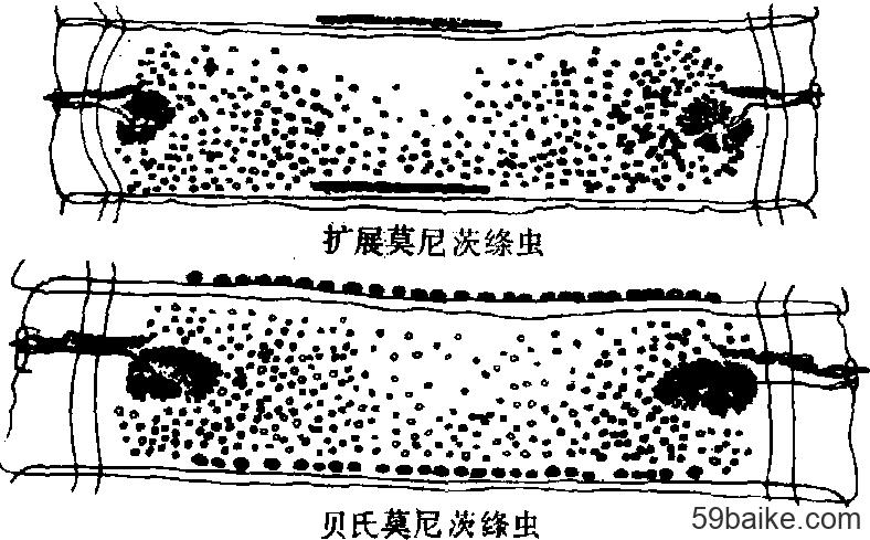 莫尼茨绦虫病