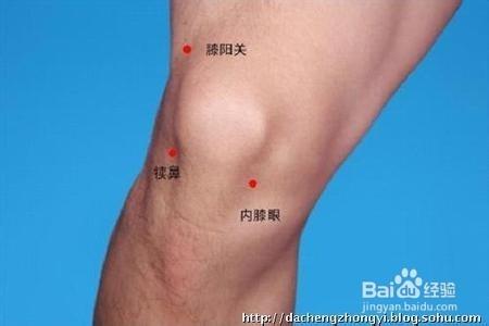 四肢软组织损伤:[5]膝关节