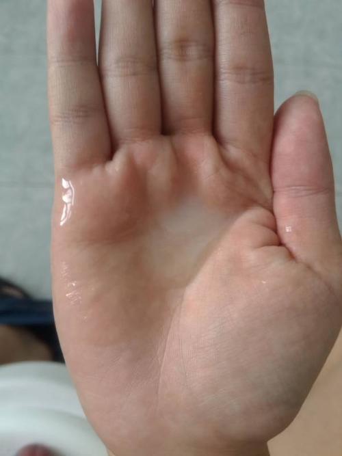 我第三次精液这样正常么?颜色有点黄