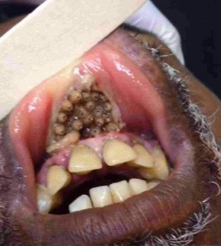 盘点世界上最恶心的图片,眼睛已被辣瞎(胆小慎入)