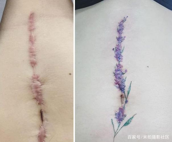 为了掩盖那些难看的伤疤,纹身师们个个脑洞大开