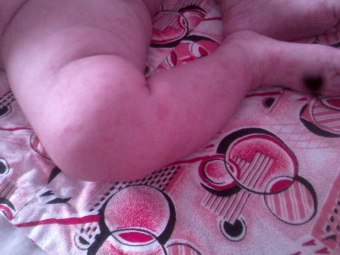 大夫看看我家宝宝起的啥