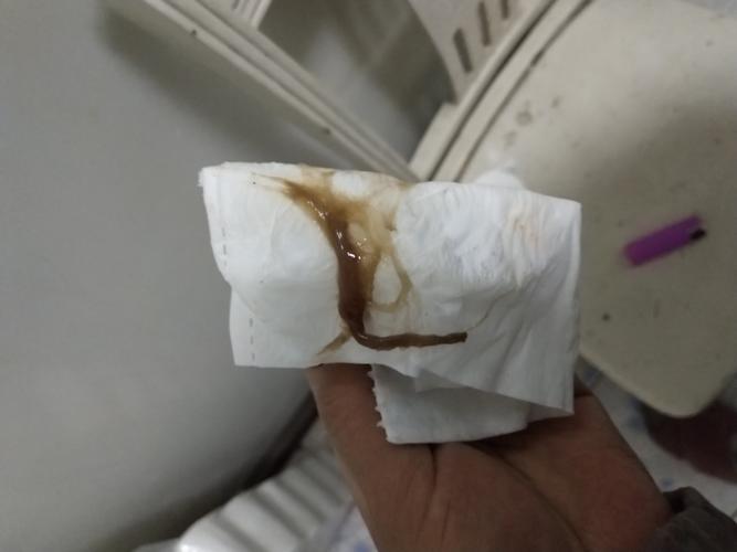 孕38 6有褐色分泌物是要临产吗?