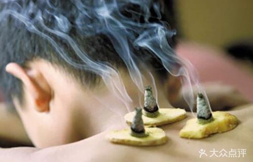 爱肤尼娜——百年古方纯手工艾灸: [艾灸]: 爱肤尼娜的"艾"是采用72