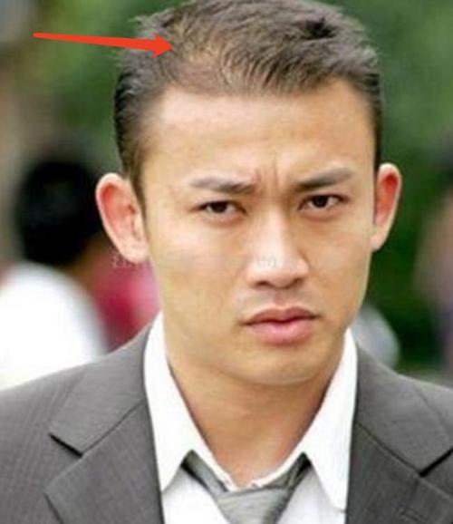 早年间,他就曾被拍到头顶头发稀疏的照片,那时候,聂远的脸还是有些