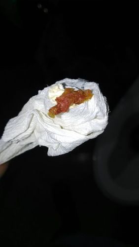 大便拉出这个东西,这几天没有吃这些东西,会不会是息肉吗?