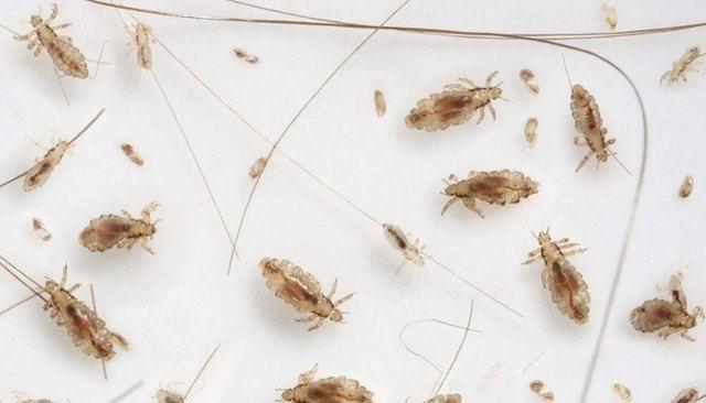 几十年前农村很多人头上都有虱子为何如今突然没了