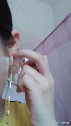 打了三个月耳洞,耳洞旁边长了一个像是血包的东西.