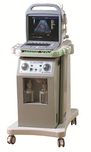 对子宫内膜损伤小,术后恢复快,有效避免子宫穿孔,吸宫不全,漏吸等并发