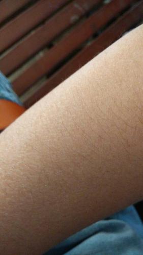 胳膊上为什么会有这种类似蛇鳞东西啊 这是怎么了 求告知怎么样才会