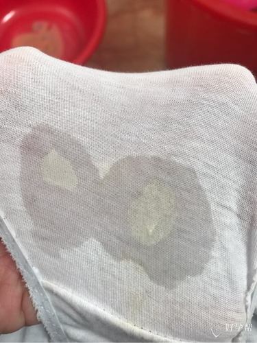 孕晚期白带这样是怎么回事