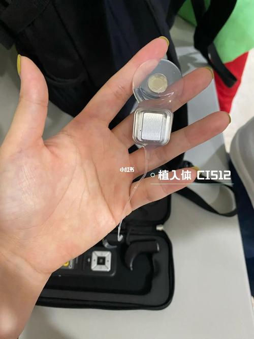 关于人工耳蜗品牌的选择_耳蜗_奥地利_澳大利亚_鱼丸