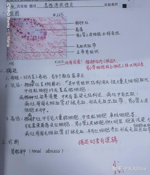 第四章:炎症 肾脓肿