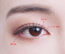 内眼角做坏了只能认命看看整形界眼大师怎么说