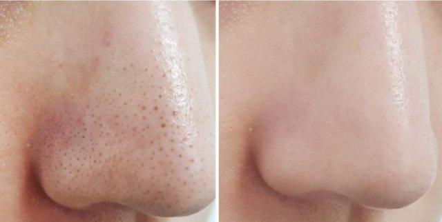 格里芬被驱逐出场的内幕,原来他发现了这件去黑头的