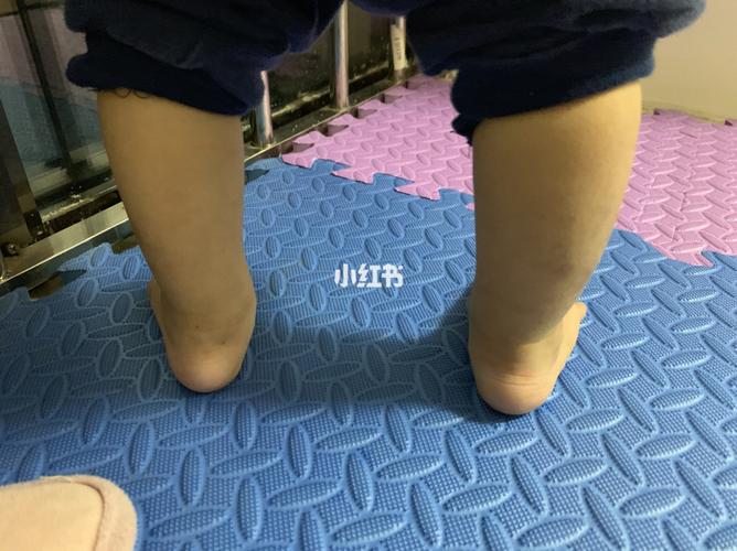 一岁的婴儿,是足内翻吗?_萌娃_母婴_育儿经验
