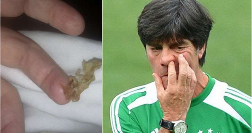 别再用手挖鼻屎了,因为这对身体造成的后果,绝对