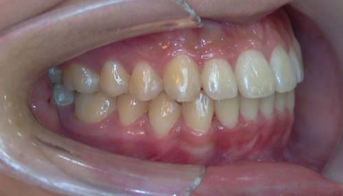 请问什么样的牙齿是正常的,详细描述如下