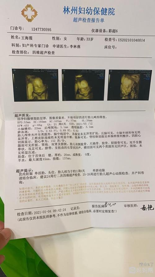 四维彩超已做,男女也知晓,大家看看是男孩