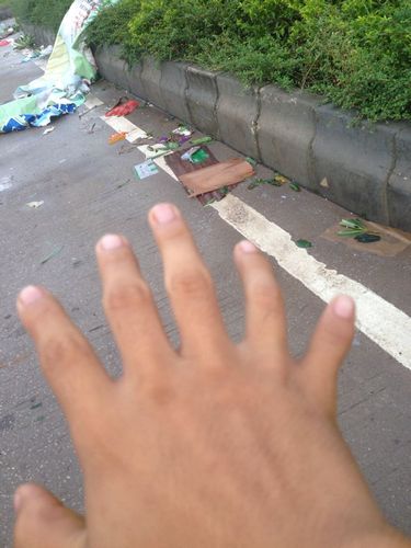 梦见自己脚手指头变成六指