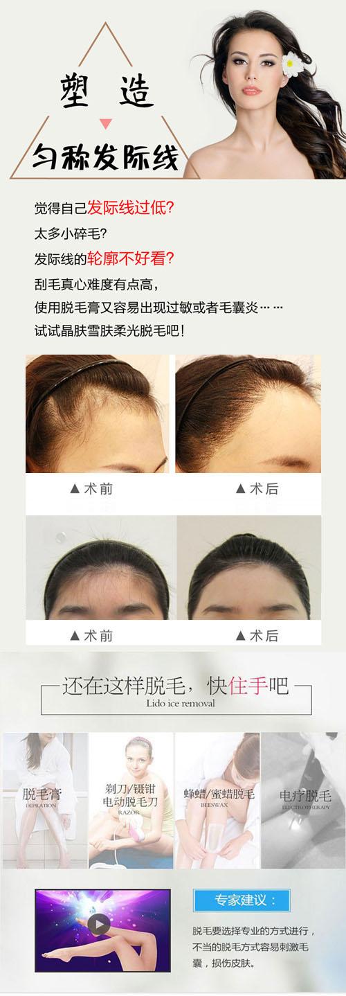 长沙激光脱发际线|脱发际线终身包干 发际线低看起来真的好蠢_悦美