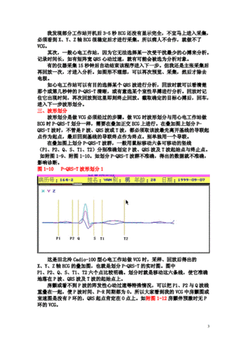 2-第二讲心电向量图的操作步骤.doc