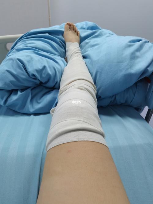 盘状半月板术后_护士_徒步_碳水_登山_运动_医疗健康