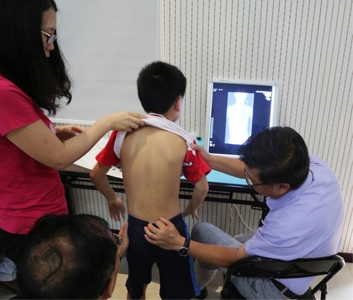 我国儿童脊柱侧凸的发病率约为千分之三专家呼吁家长