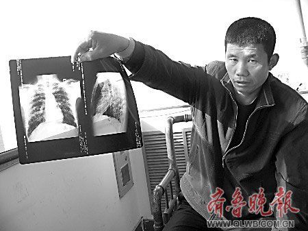 哥儿俩染"尘肺"鉴定难 开不出职业史证明(图)