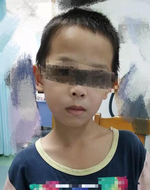 孩子歪脖子应该怎么办