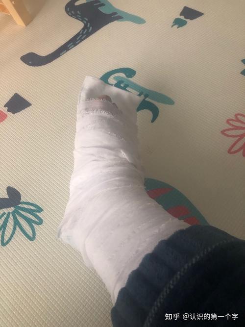 附上打绷带的伤脚一只