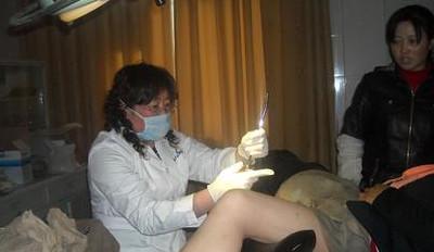 静脉麻醉状态下进行的器械性的人工流产手术,作为避孕失败后的补救