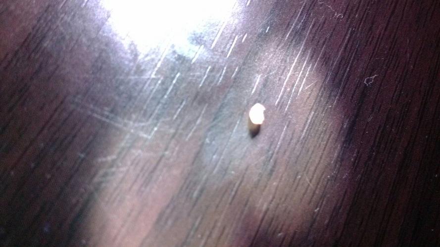 我从屁股皮肤里挤出这个白色的东西,还留了好多血,这是什么