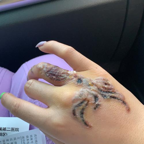 洗纹身_纹身_发炎_祛疤_美妆_彩妆