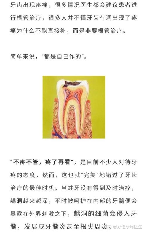 原来根管治疗费用是这么算的!