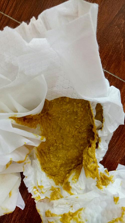 宝宝两个半月了,吃奶粉,一直拉这样的粑粑,还天天喝合生元益生菌,一天