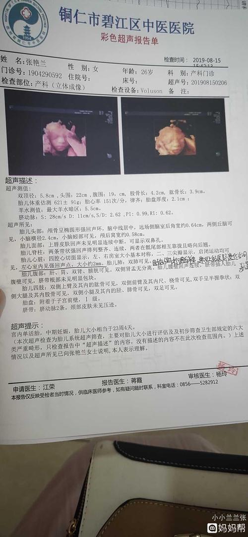 四维彩超已过所以症状女宝太开心