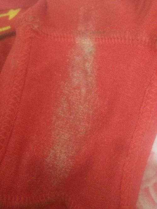 孕晚期内裤上有这种白带正常吗