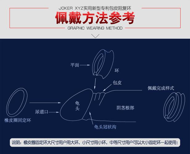 新款xyz 八角型环 假性包茎纠正器 包皮阻复环阻复器