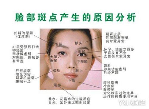 【图】脸上长斑位置图解大全 对症下药包你药到斑除
