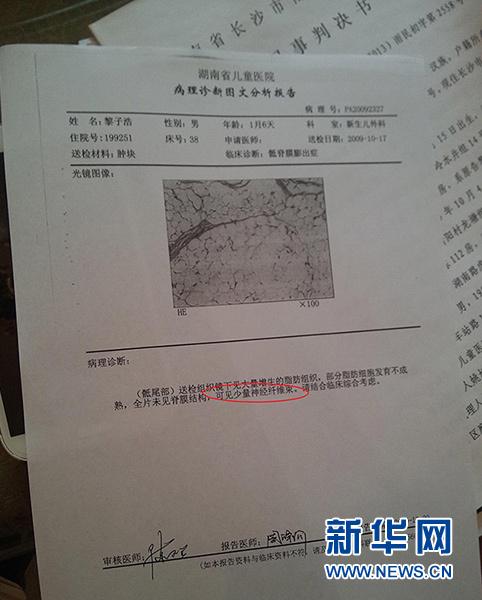 湖南省儿童医院病理诊断报告单