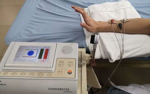 (2)高频磁,功能性电刺激等治疗可促进神经功能的修复.