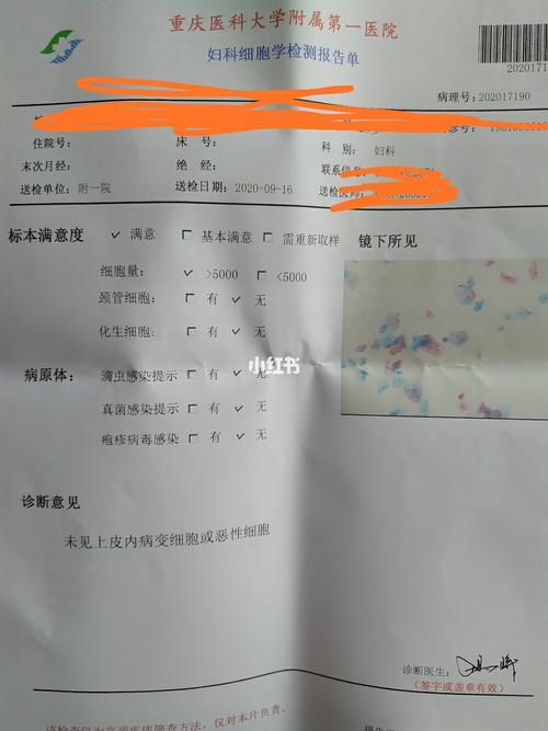 宫颈癌筛查/hpv疫苗/宫颈癌疫苗_宫颈癌_疫苗_哺乳期