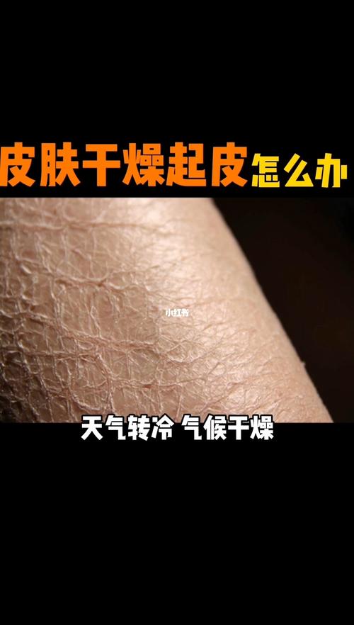 皮肤干燥起皮屑,怎么治?_皮肤干燥_内行才知道_知识