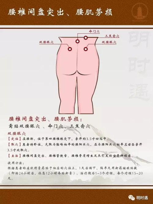 久坐工作的人,每隔一会儿就起身活动活动腰部,睡觉前做些锻炼腰部的