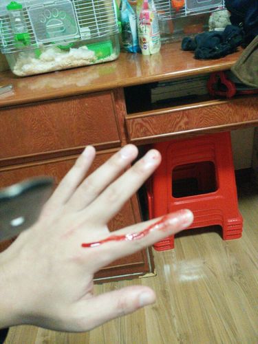 刚被仓鼠咬了怎么办?