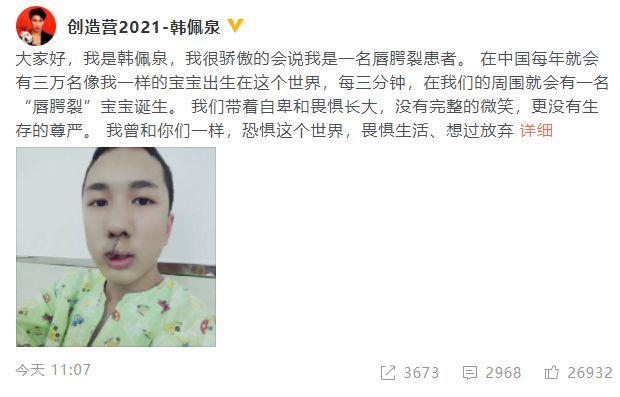 网红韩美娟晒唇腭裂时期照片呼吁大家给予患者温暖